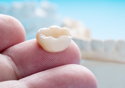Dental crowns can vary in cost depending on a variety of factors