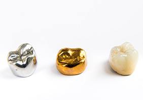 The cost of dental crowns can vary depending on the materials they are made from