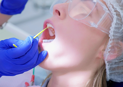 Dental patient having fluoride applied to upper teeth