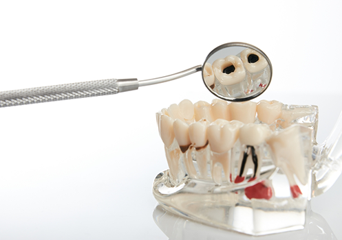Dental mirror leaning against model of teeth