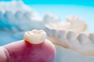 Dental crown. 